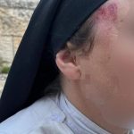 Jerusalem’s Sacred Fault Lines: Nun’s Assault Rattles Fragile Coexistence