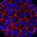 A ‘Death Sentence’ Deferred? Pancreatic Cancer Pill Offers Whispers of Hope