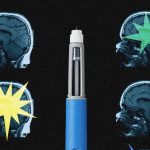 Ozempic’s Enigmatic Enigma: A Deep Dive into the Drug’s Potential Neural Revisions