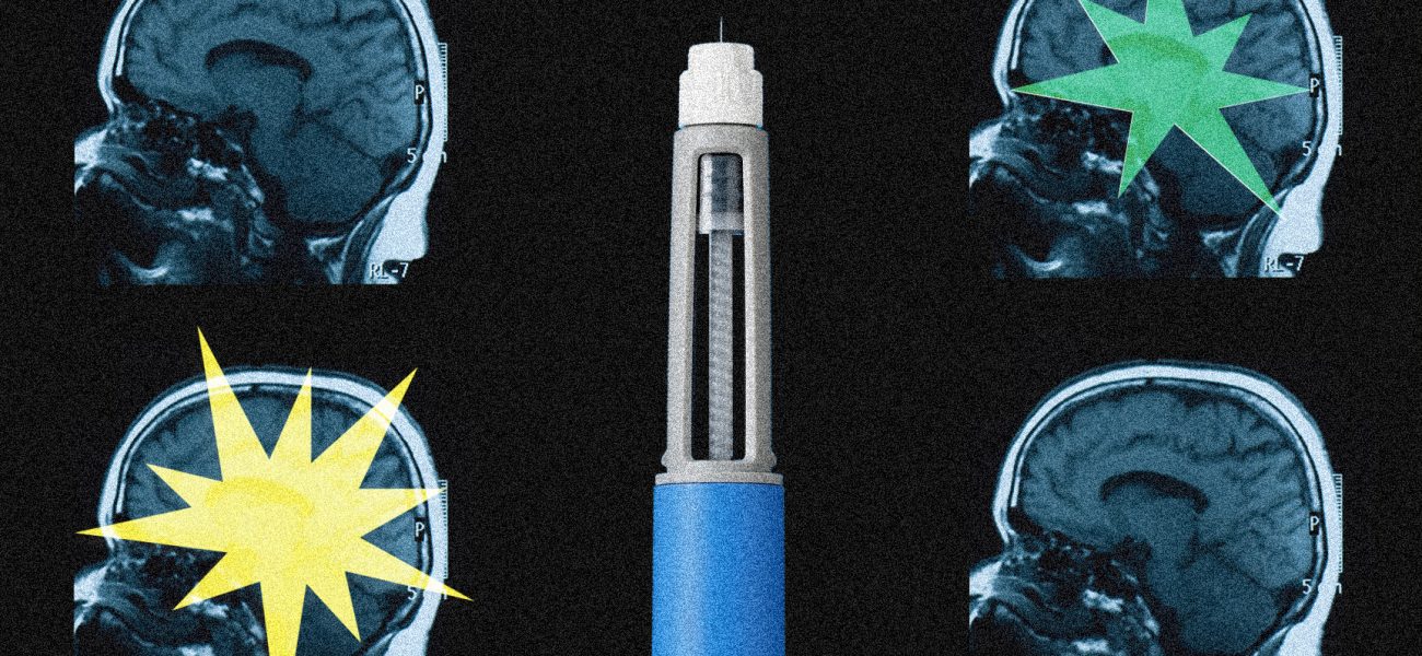 Ozempic’s Brain Tease: The Unseen Costs of Appetite Suppression