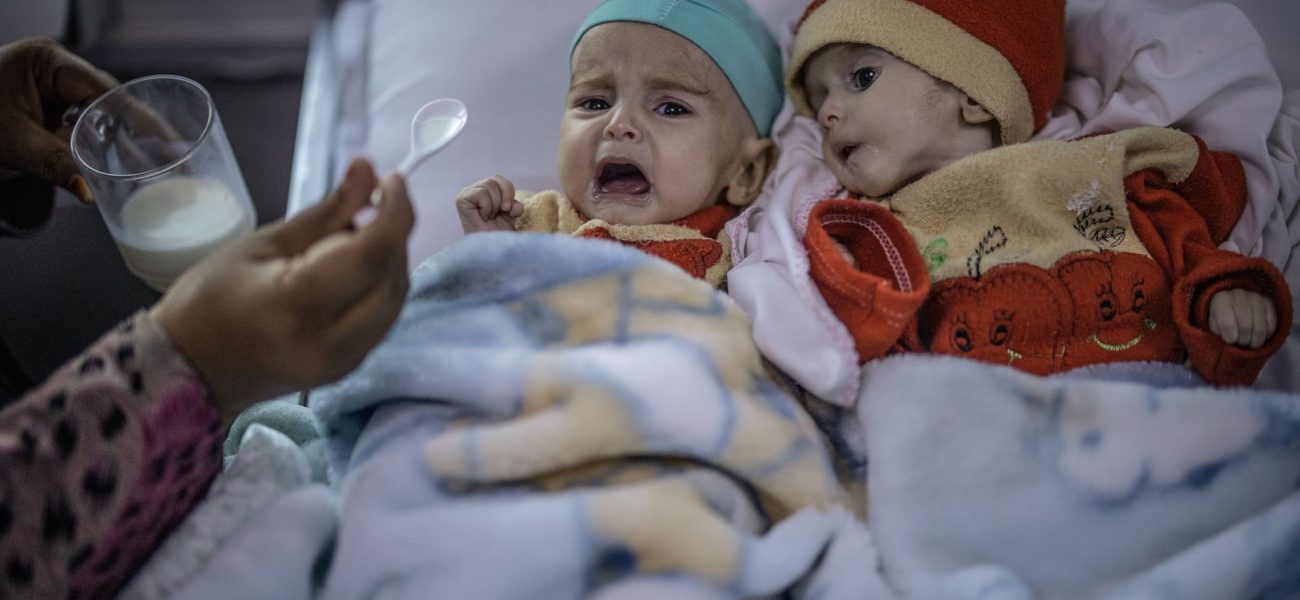 Kabul’s Silent Attrition: Child Malnutrition Surges as Afghanistan Slips from Global View