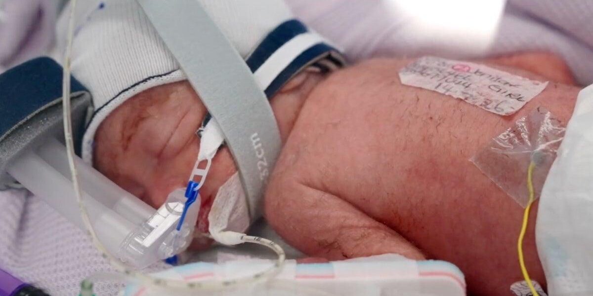 Australian Woman Delivers Identical Quadruplet Girls in Rare Pregnancy