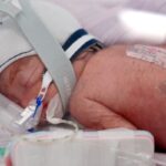 Australian Woman Delivers Identical Quadruplet Girls in Rare Pregnancy Australian Woman Delivers Identical Quadruplet Girls in Rare Pregnancy