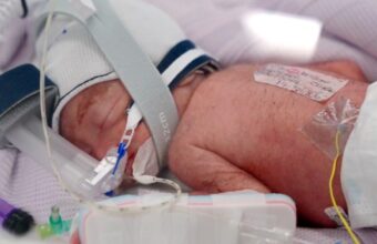 Australian Woman Delivers Identical Quadruplet Girls in Rare Pregnancy