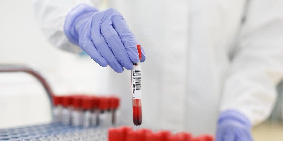 Revolutionary Blood Test Offers Early Detection of Debilitating Disease