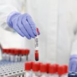 Revolutionary Blood Test Offers Early Detection of Debilitating Disease Revolutionary Blood Test Offers Early Detection of Debilitating Disease