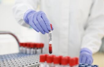Revolutionary Blood Test Offers Early Detection of Debilitating Disease