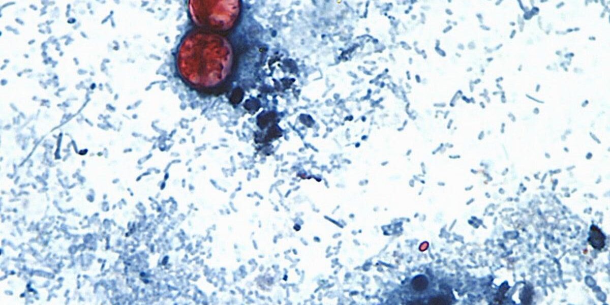 UK Issues Holiday Warning as Cyclospora Outbreak Spreads