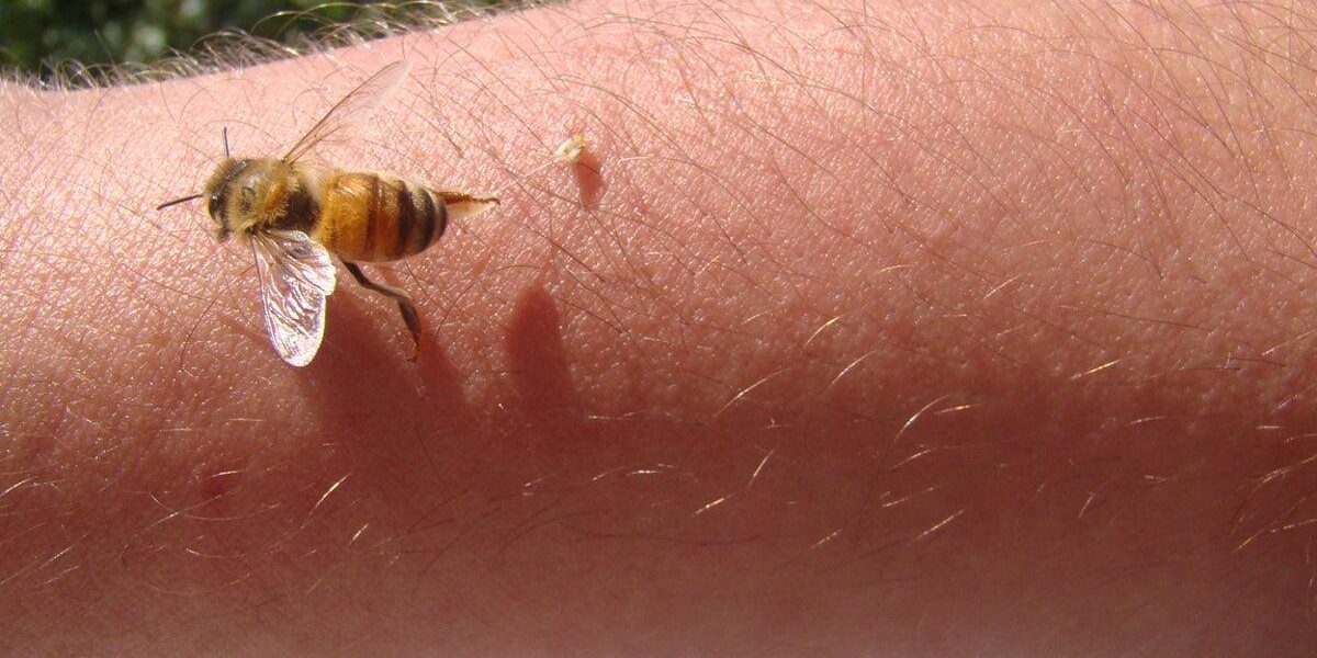Savannah Spoor Turns to Bee Venom Therapy for Lyme Disease Symptoms