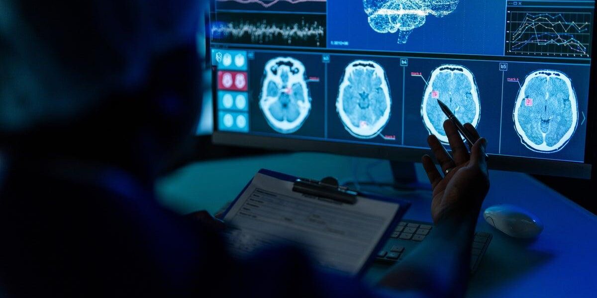 Groundbreaking Advances in Treating Cerebral Small Vessel Disease