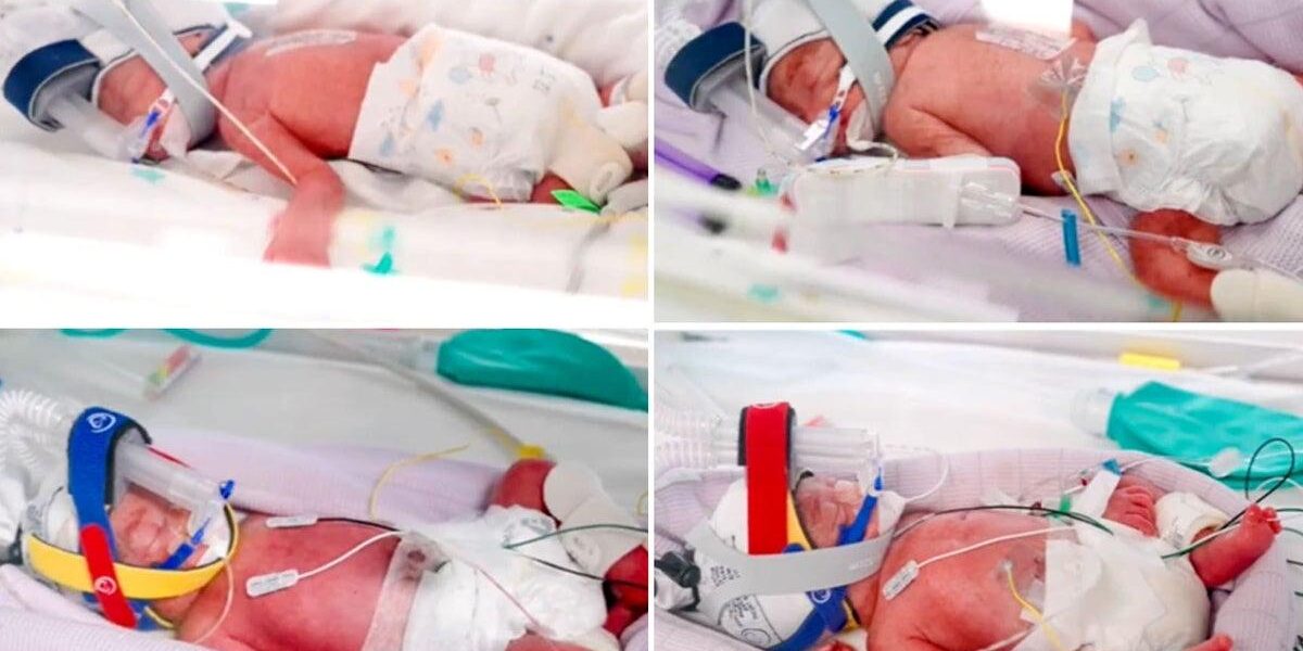 Mother Delivers Rare Identical Quadruplets in Astonishing ‘One in 15 Million’ Birth