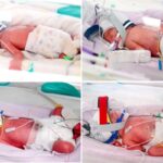 Mother Delivers Rare Identical Quadruplets in Astonishing ‘One in 15 Million’ Birth Mother Delivers Rare Identical Quadruplets in Astonishing ‘One in 15 Million’ Birth