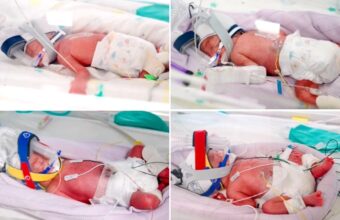 Mother Delivers Rare Identical Quadruplets in Astonishing ‘One in 15 Million’ Birth