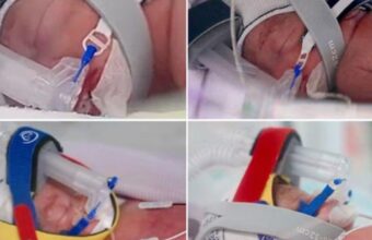 Australian Woman Delivers Identical Quadruplet Girls in Rare Pregnancy