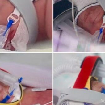 Australian Woman Delivers Identical Quadruplet Girls in Rare Pregnancy