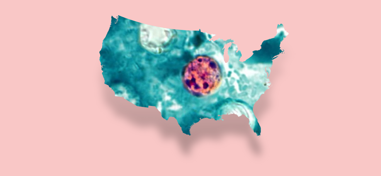 Michigan’s Cyclosporiasis Quagmire: Bureaucratic Lag Casts Long Shadow