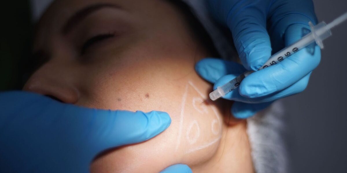 Botox Injections for TMJ Pain Relief Surge Among Young Women