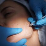 Botox Injections for TMJ Pain Relief Surge Among Young Women Botox Injections for TMJ Pain Relief Surge Among Young Women