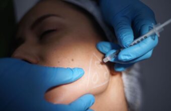 Botox Injections for TMJ Pain Relief Surge Among Young Women