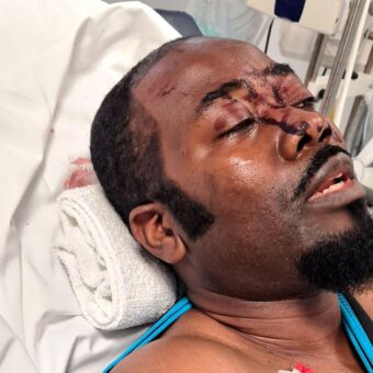 Manchester Synagogue Guard’s Life Altered by Violent Attack