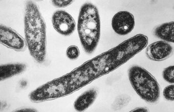 Manhattan’s Microbe Miasma: Legionnaires’ Outbreak Exposes Elite Vulnerability