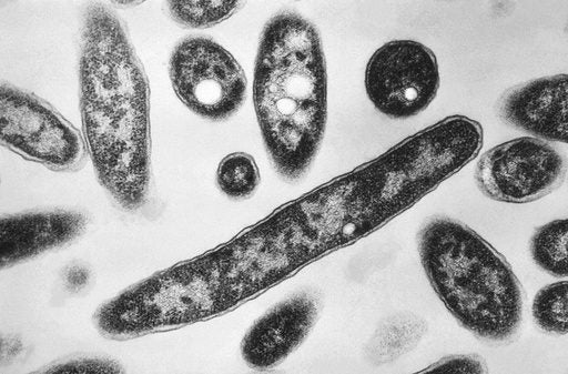 Manhattan’s Microbe Miasma: Legionnaires’ Outbreak Exposes Elite Vulnerability