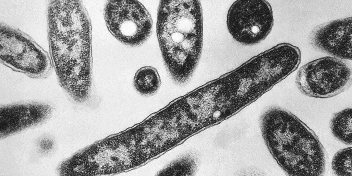 First Fatality Reported in NYC Legionnaires’ Disease Outbreak