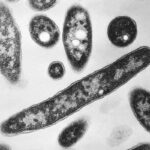 First Fatality Reported in NYC Legionnaires’ Disease Outbreak