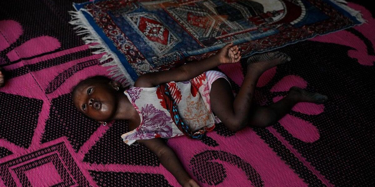 Nigerian Children Suffer from Surging Malnutrition Amid Middle East Conflict