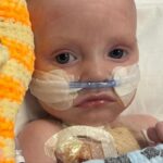 Infant Defies Odds: Thriving Post Life-Saving Heart Surgery