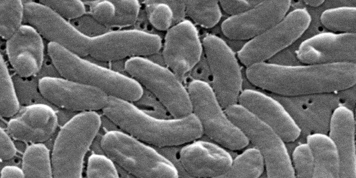 Global Alert: Vibrio vulnificus Infections Surge Worldwide Global Alert: Vibrio vulnificus Infections Surge Worldwide