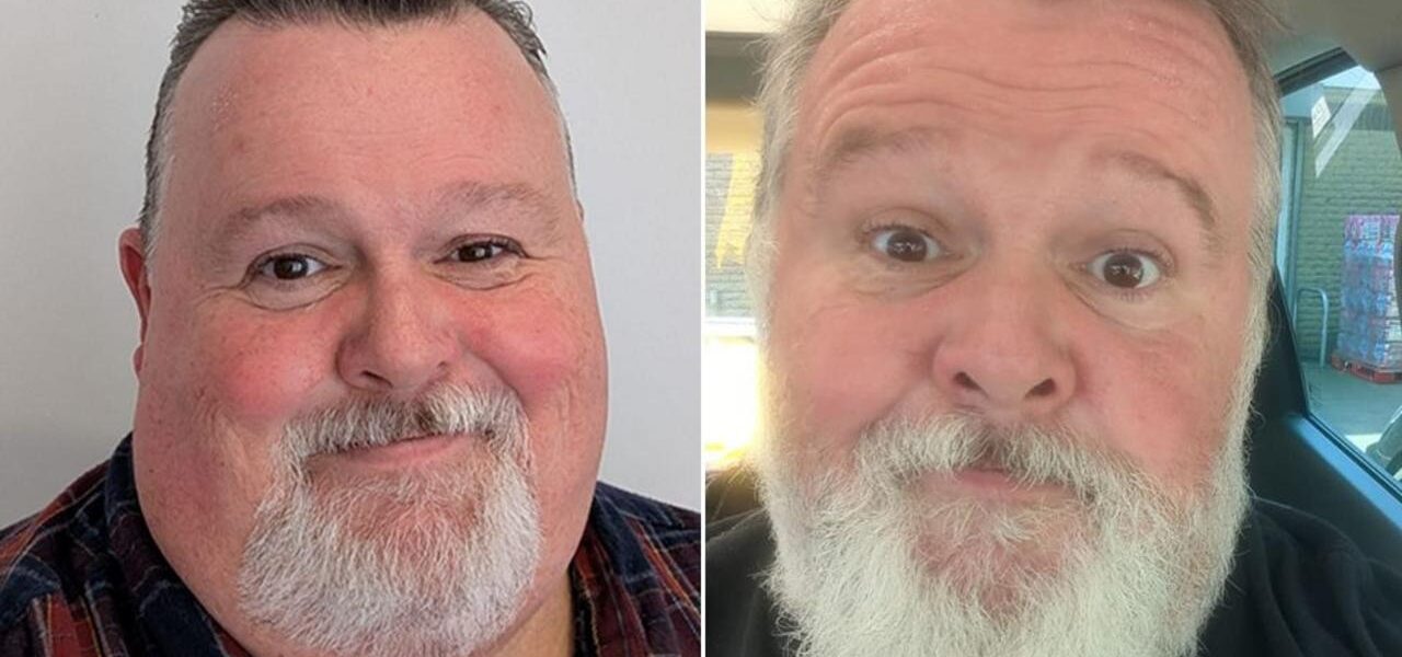 Men’s Reluctance to Discuss Weight-Loss Medications Explored