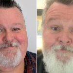 Men’s Reluctance to Discuss Weight-Loss Medications Explored Men’s Reluctance to Discuss Weight-Loss Medications Explored