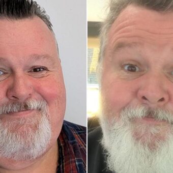 Men’s Reluctance to Discuss Weight-Loss Medications Explored