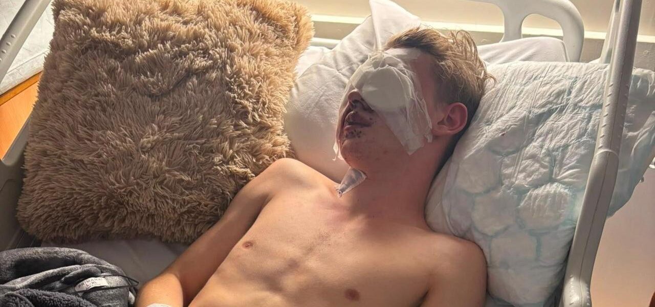 Injured Teen Advocates for Firework Sales Ban After Blinding Accident Injured Teen Advocates for Firework Sales Ban After Blinding Accident