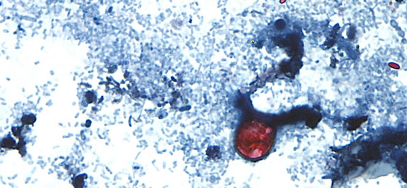 US State Faces Crisis as ‘Explosive Diarrhoea’ Infection Surges, Claiming Two Lives