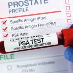 UK Prostate Cancer Cases Surge, Charity Warns Against Misconceptions UK Prostate Cancer Cases Surge, Charity Warns Against Misconceptions