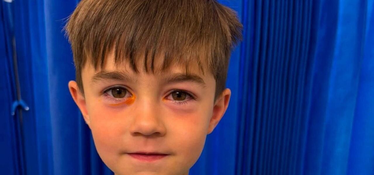 Four-Year-Old Hospitalized After Counterfeit Toy Explodes