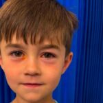 Four-Year-Old Hospitalized After Counterfeit Toy Explodes Four-Year-Old Hospitalized After Counterfeit Toy Explodes