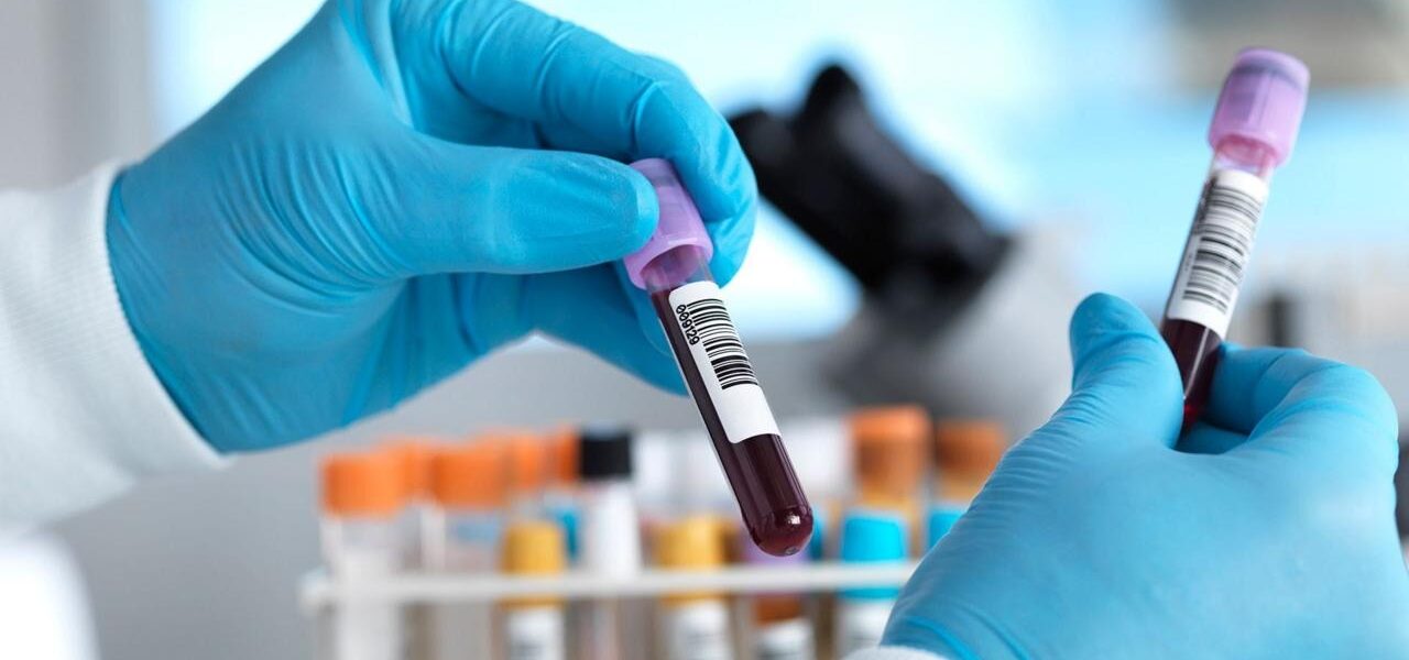 England Nears Historic Milestone in Hepatitis C Elimination England Nears Historic Milestone in Hepatitis C Elimination