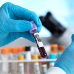 England Nears Historic Milestone in Hepatitis C Elimination