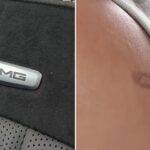 Drivers Sue Mercedes-Benz Over Alleged Burns from Car Logo Drivers Sue Mercedes-Benz Over Alleged Burns from Car Logo