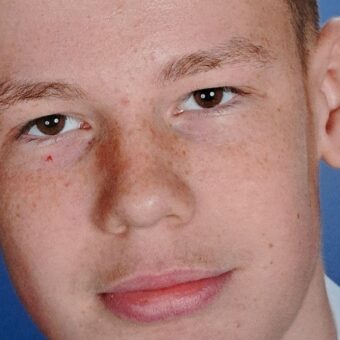 Tragic Incident: 16-Year-Old Dies After Collapsing Near Scottish River