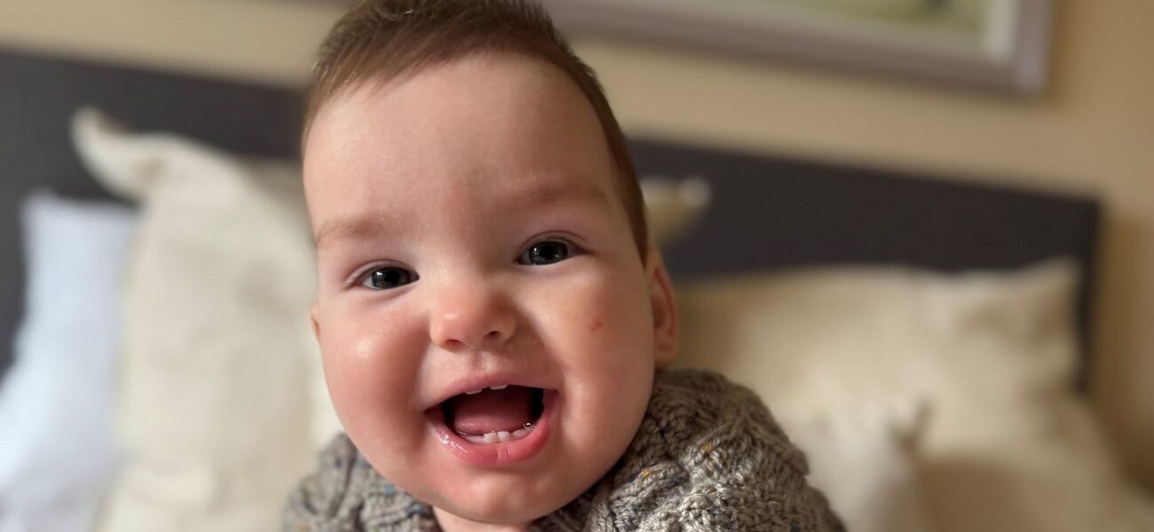 World-First Surgery Saves Baby Boy with Rare Skull Condition World-First Surgery Saves Baby Boy with Rare Skull Condition