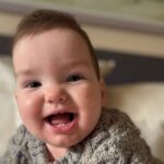 World-First Surgery Saves Baby Boy with Rare Skull Condition